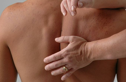 Rolfing
